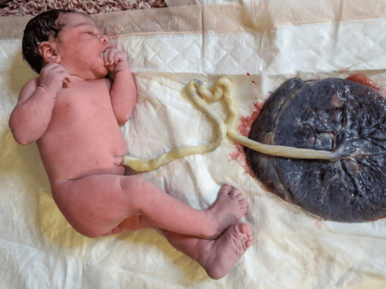 Amanda’s Journey Through Childbirth from Unplanned Cesarean to Three Empowering Homebirths